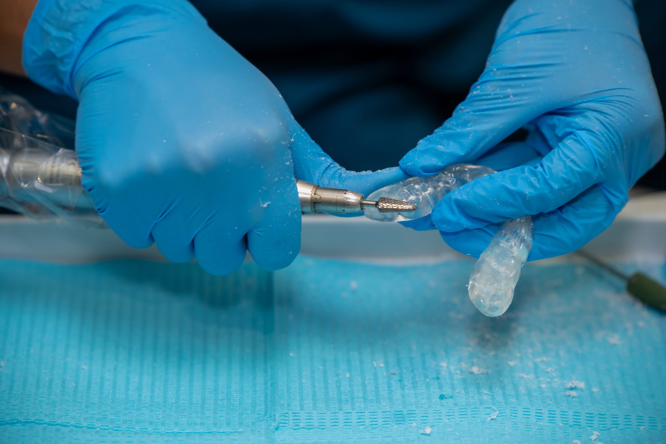 Other Dentistry teeth grinding treatment - preston